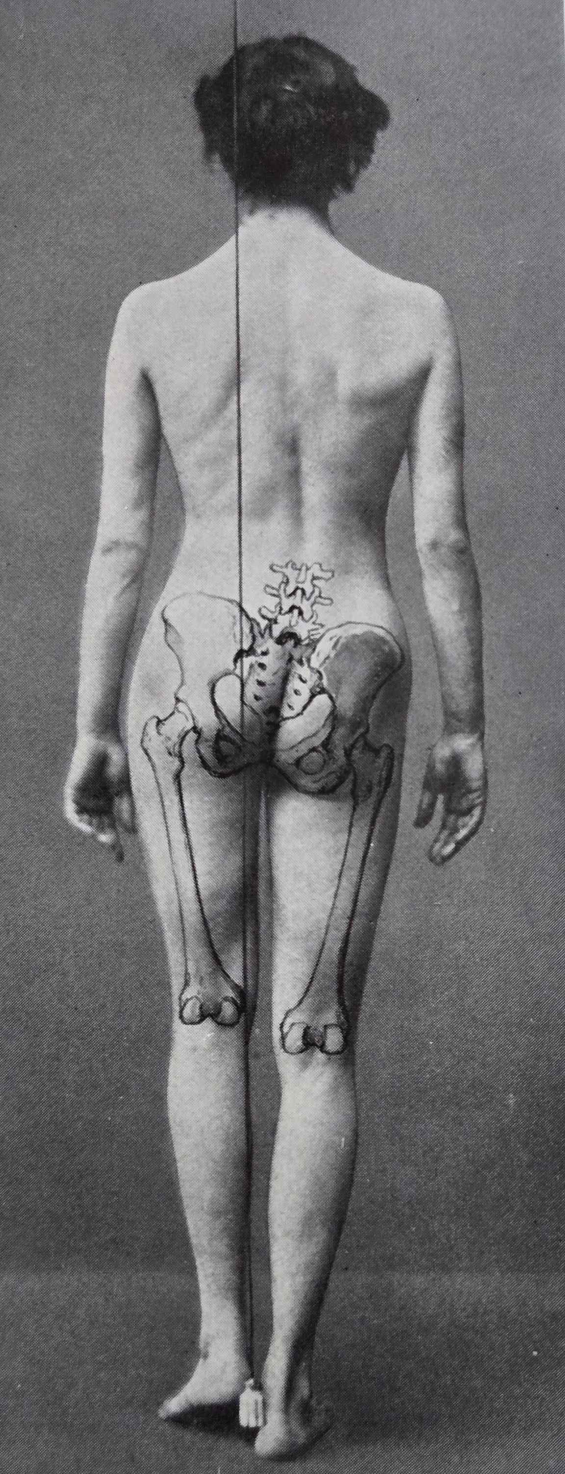 Bess M. MENSENDIECK