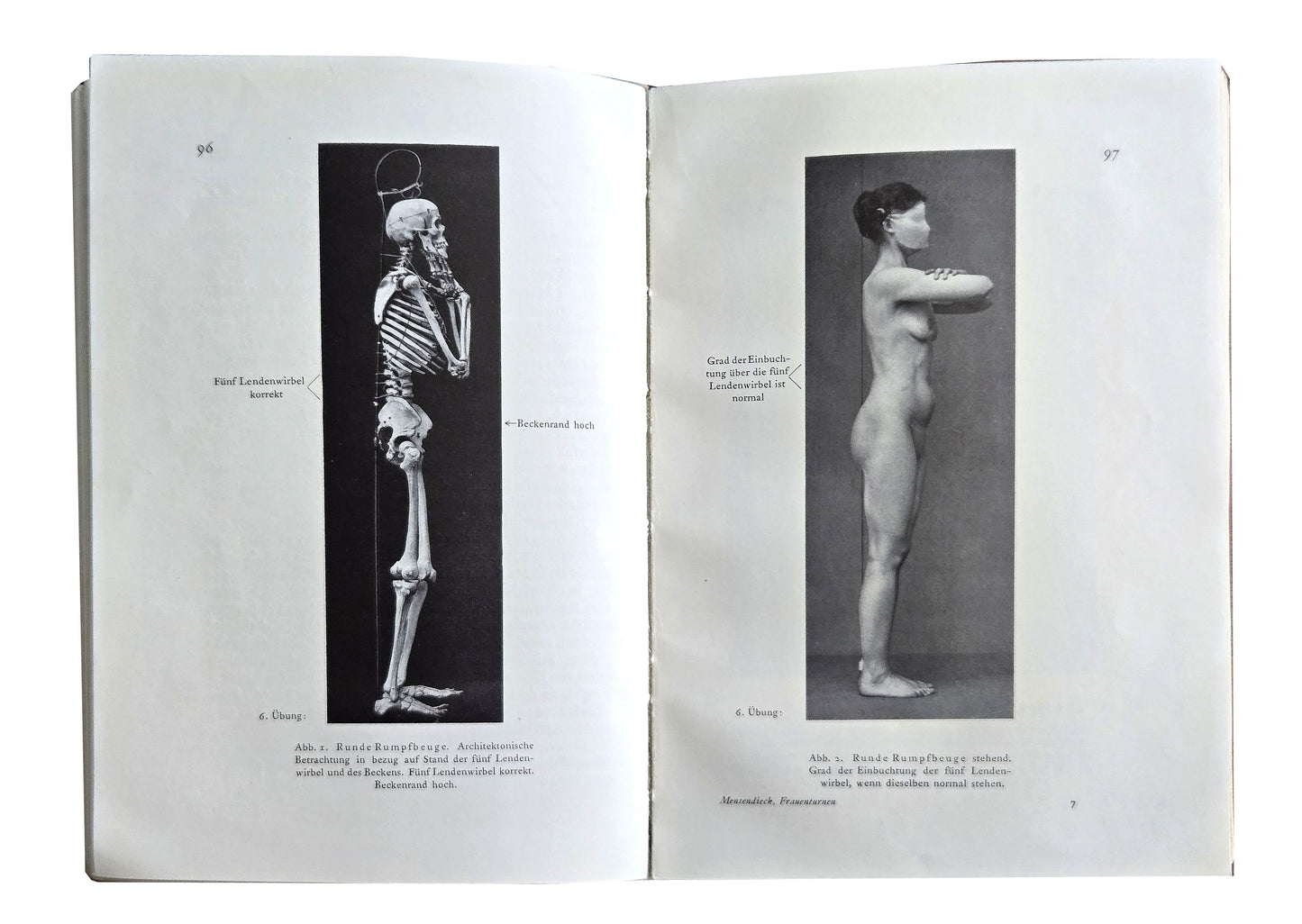 Bess M. MENSENDIECK